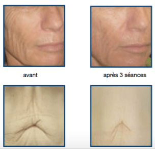 Capture d_écran 2018-08-16 à 14.03.38